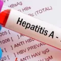 Waspadai Gejala Hepatitis A, Penyebab Dan Cara Penularannya